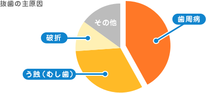 抜歯の主原因