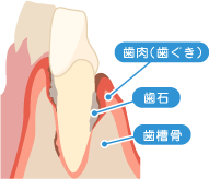 歯の構造