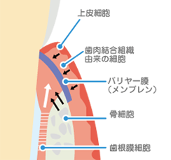 GTR法による再生療法